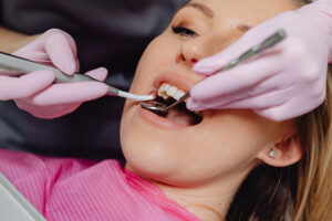 Dental Treatments: Teeth cleaning