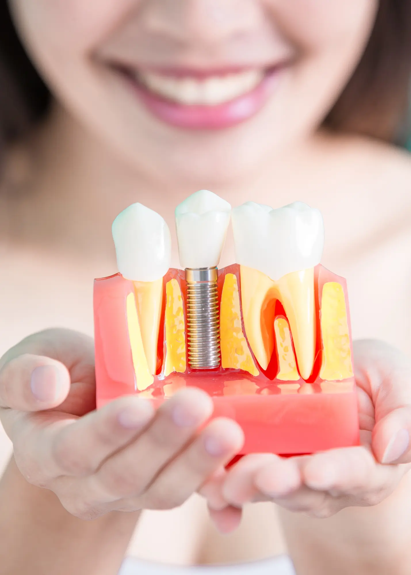 Garden Valley Family & Cosmetic Dentistry's Dental Implant treatment