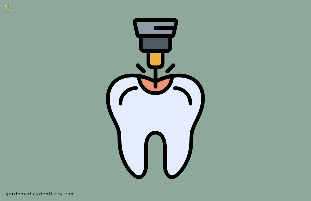How Much Does Laser Dentistry Cost? by Garden Valley Dentistry