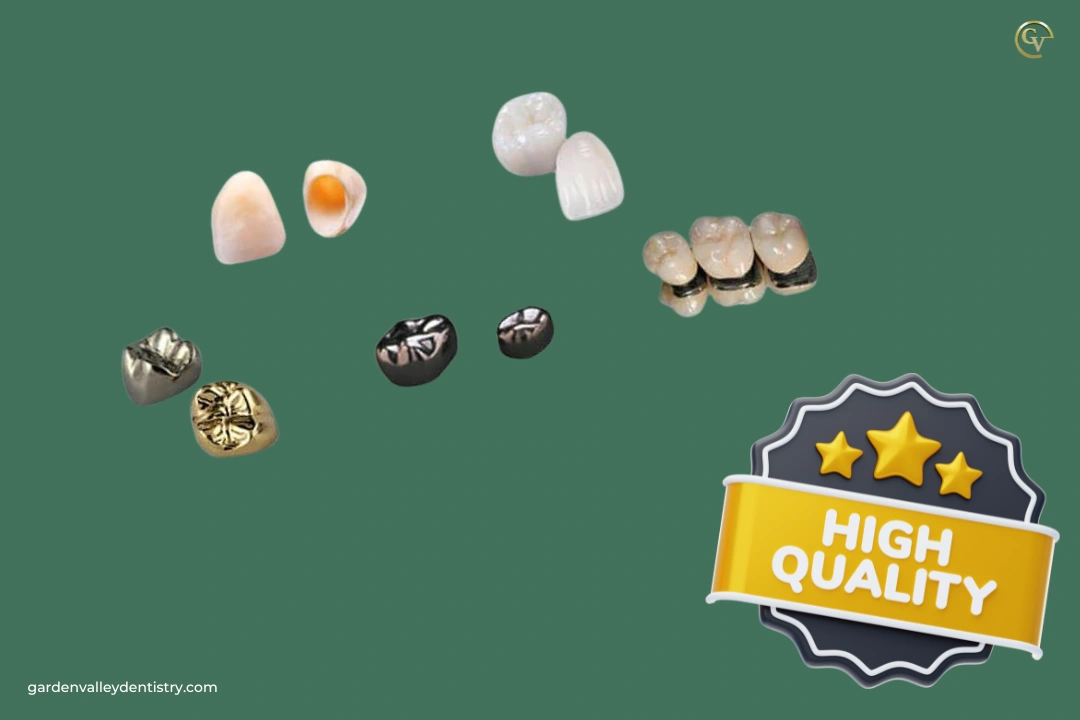 Best Practices for a Quality Crown