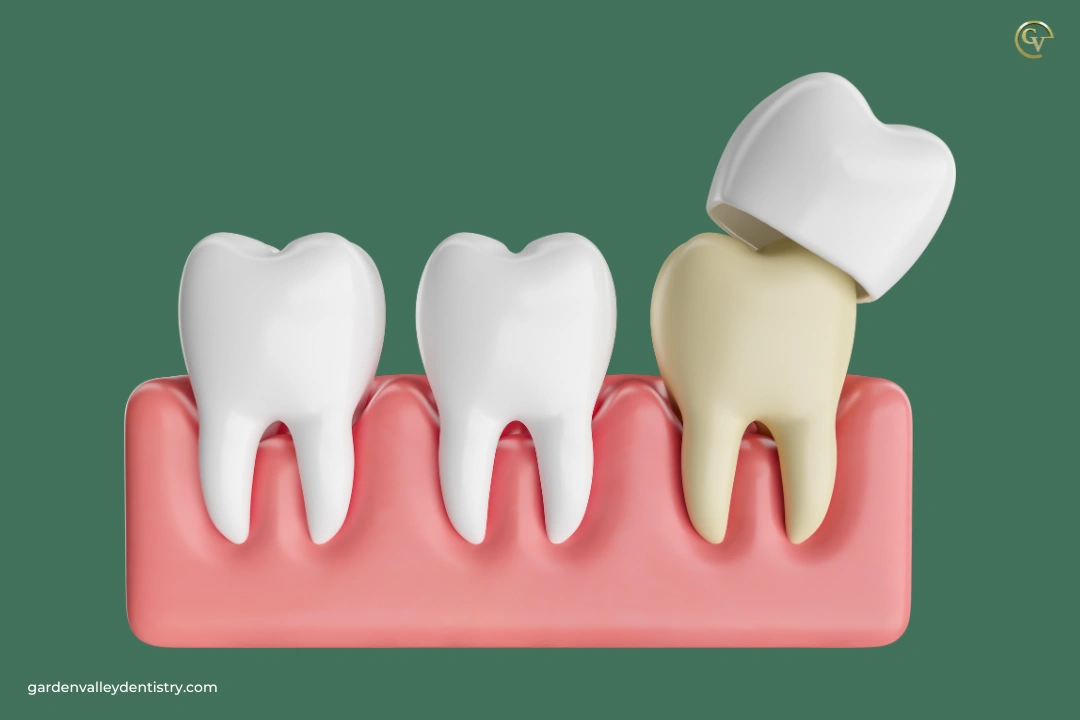 Best Practices for a Quality Crown Delivery Set up