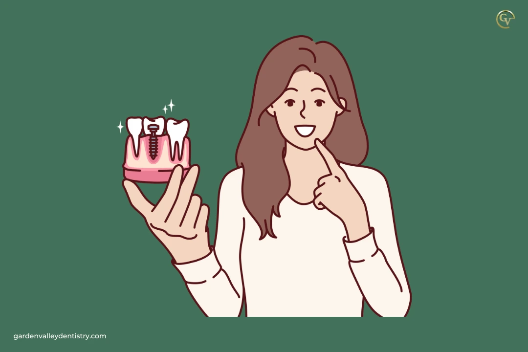 Dental Implant Procedures: A Detailed Guide for Patients