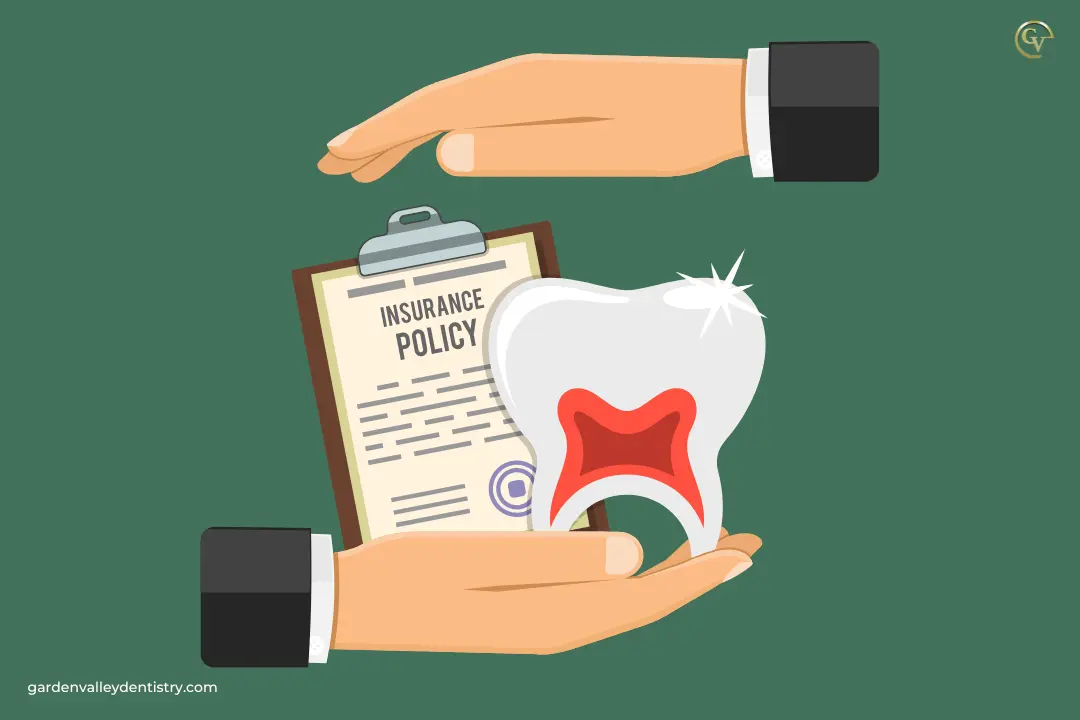 How Much Are Dental Implants