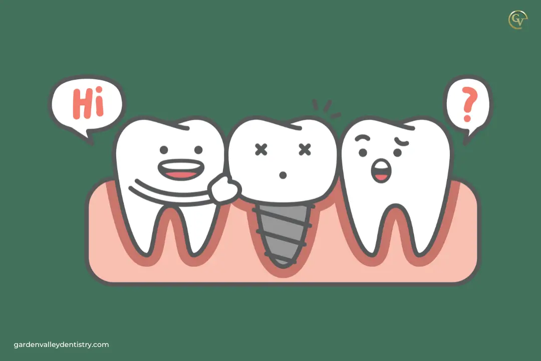 How Much Are Dental Implants