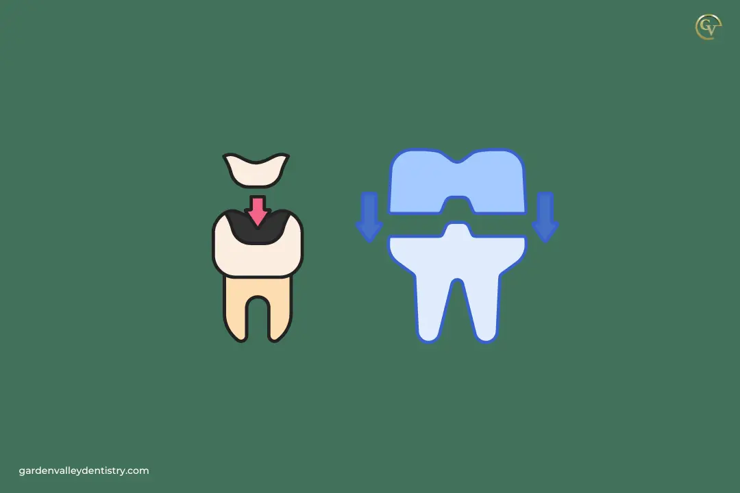 Which Dental Treatment is Best