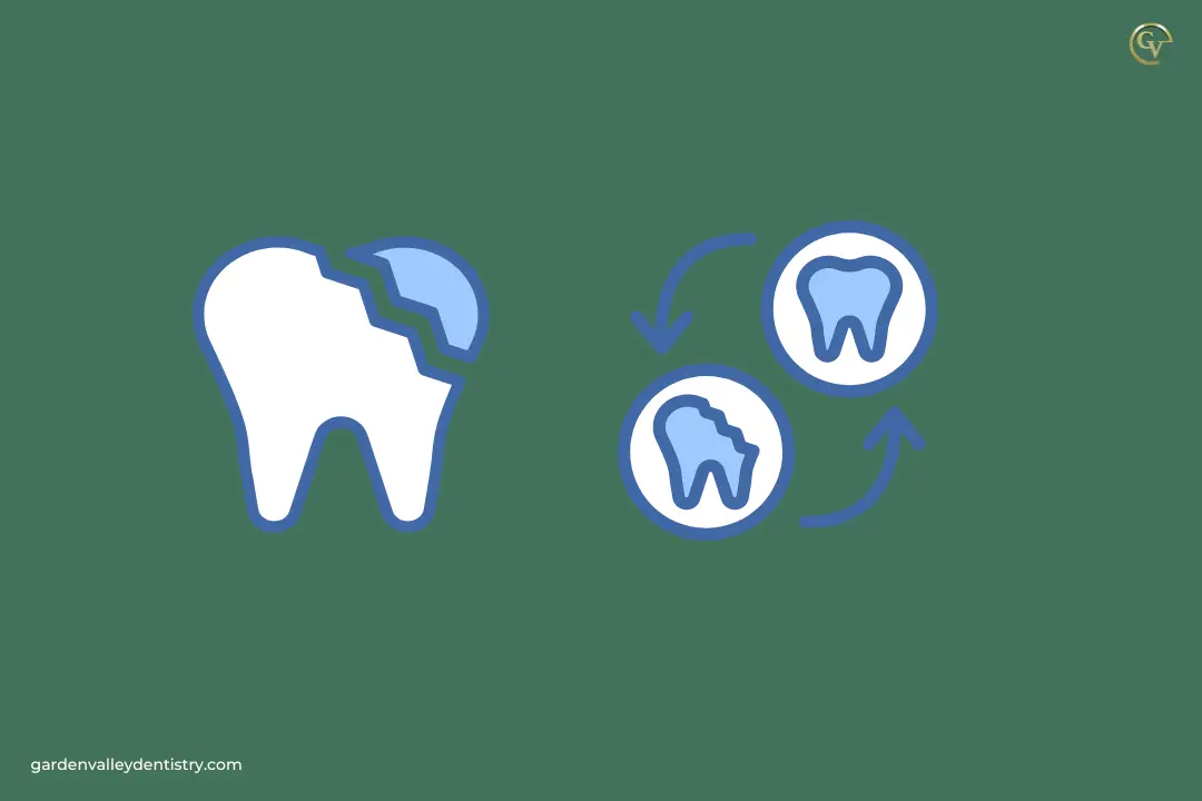 Which Dental Treatment is Best