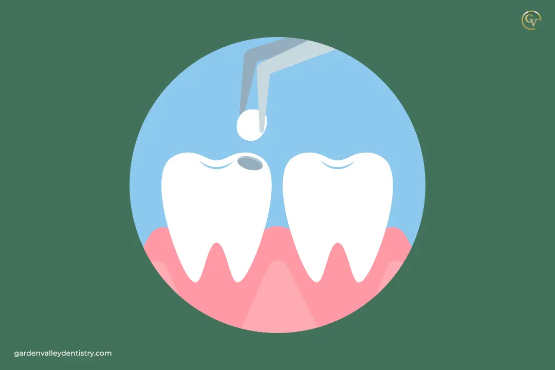 Which Dental Treatment is Best