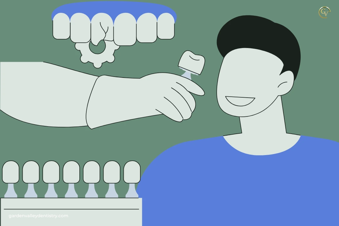 Who Is a Good Candidate for No Prep Veneers