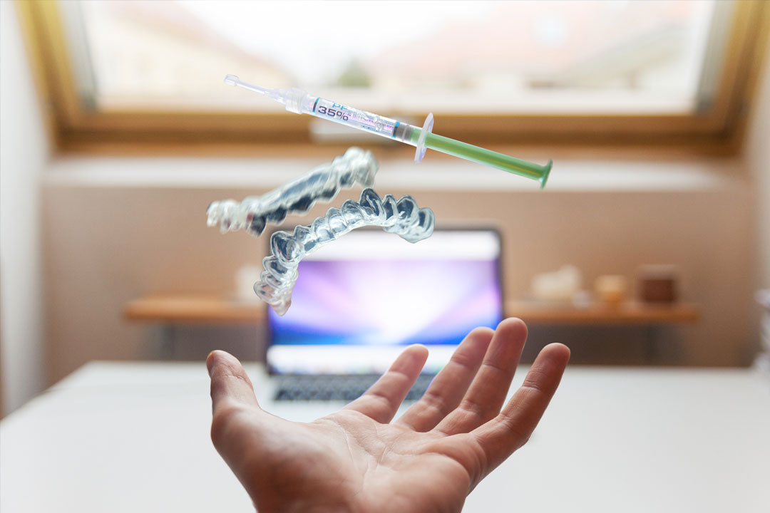 dental bonding Dental bonding