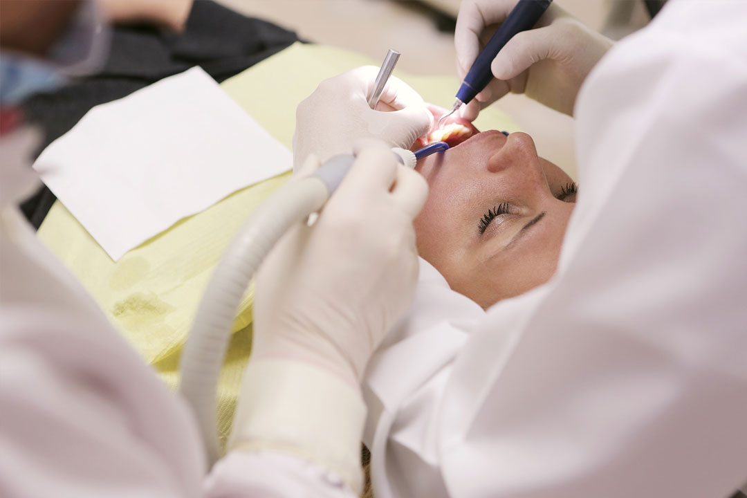 root canal Root canal