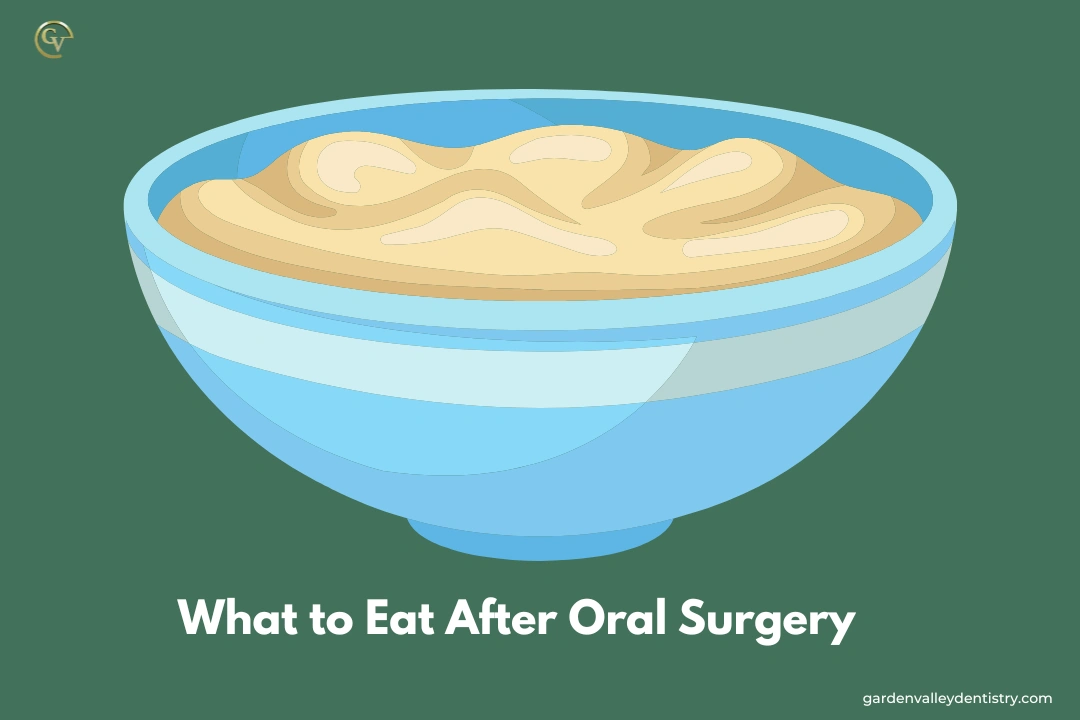 What food should I eat