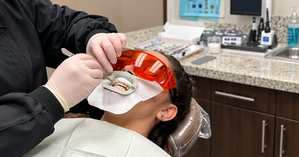 Dr. Rhea Antolin is creating a mold for the patient's clear aligners set